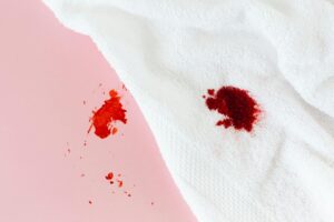 Understanding Stain Transfer Between Surfaces