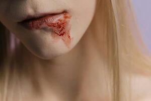15 Best Stain Removers for Blood in 2026